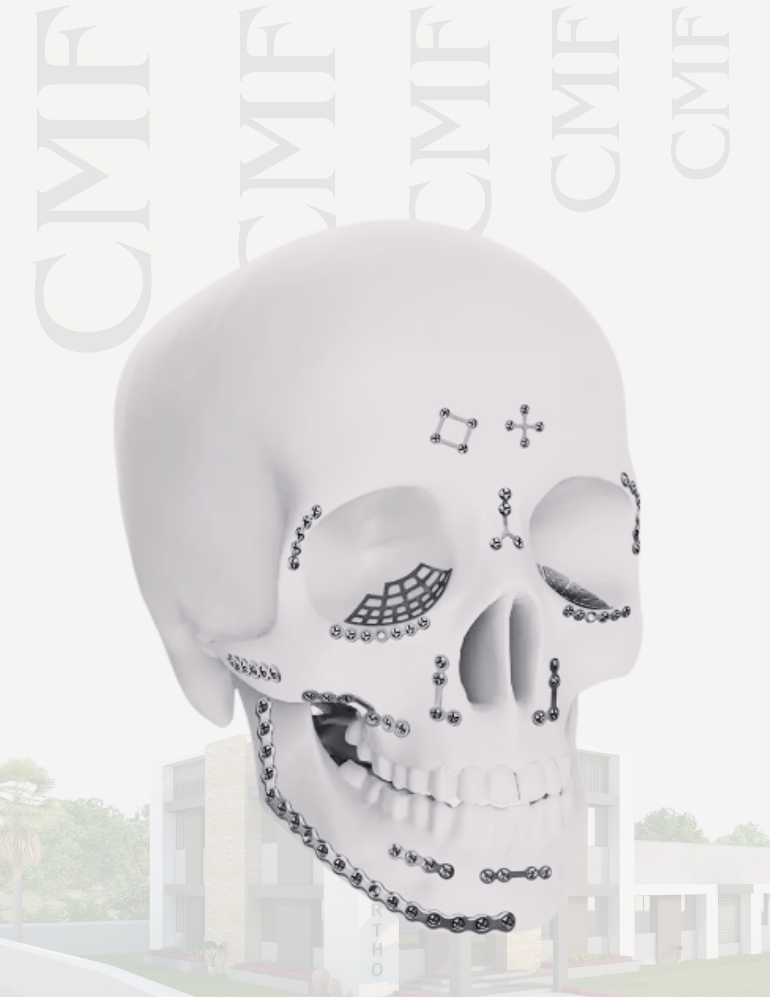 Cranio-Maxillofacial System implant and specification presentation