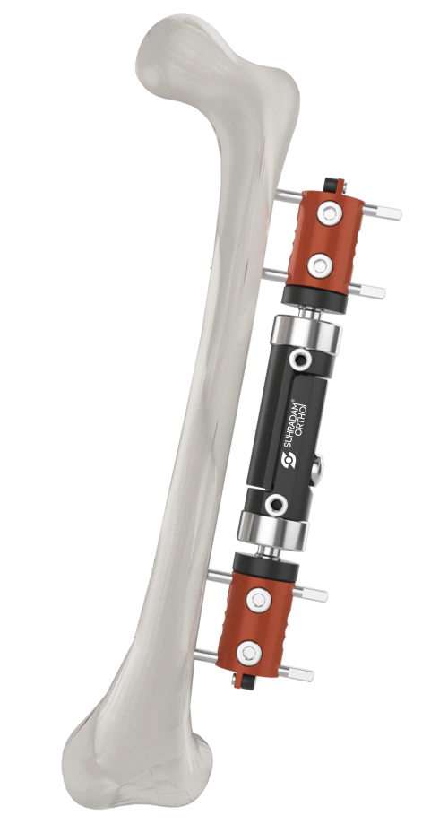 Dynamic External Fixator Type 2 product image